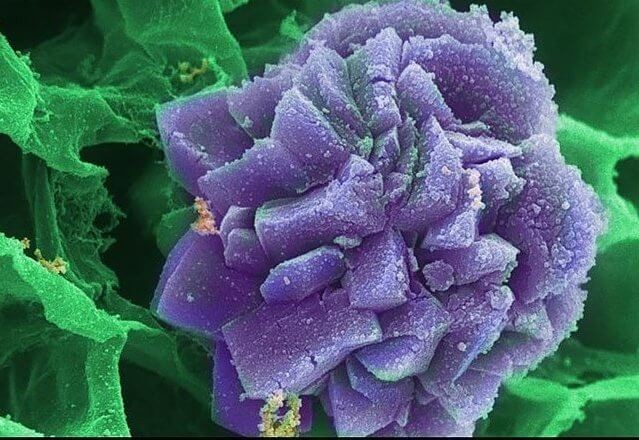 Кристалл оксалата кальция